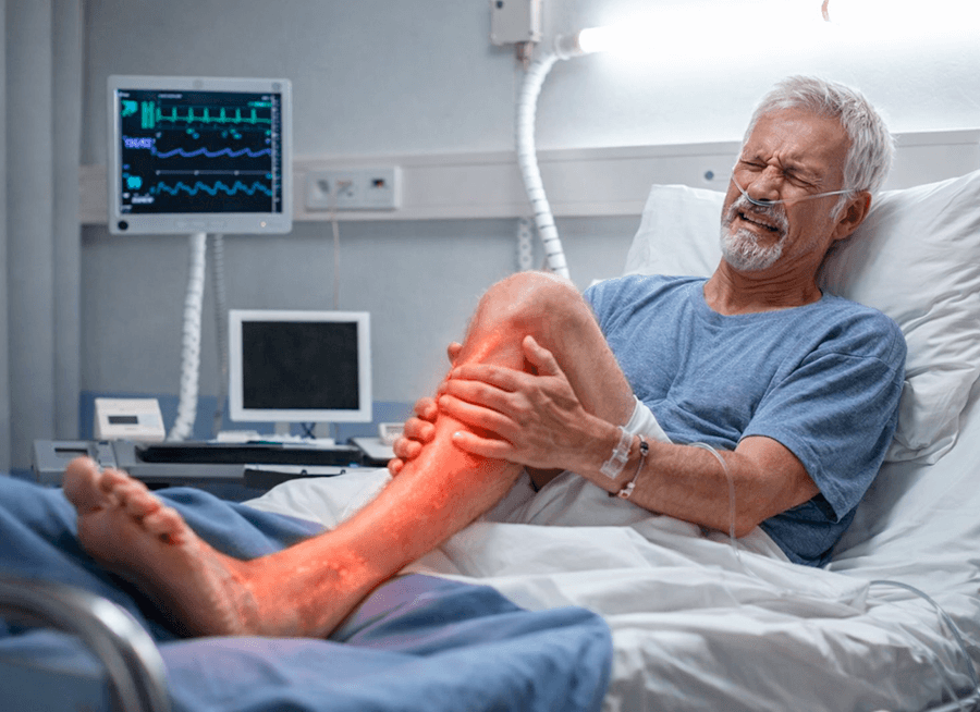 image diabetic neuropathy